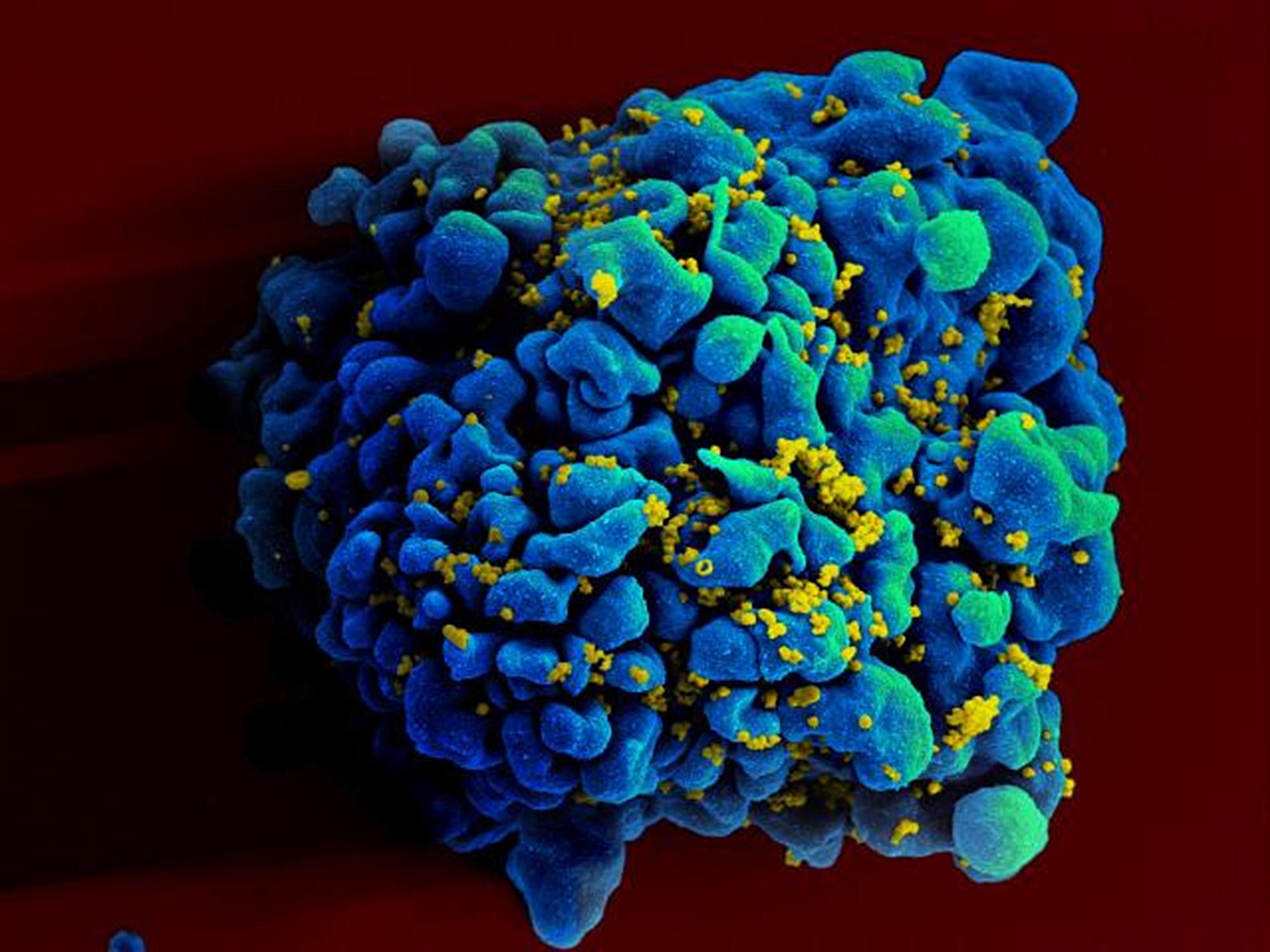 Novas descobertas sobre o raro vírus Chapare preocupam pesquisadores